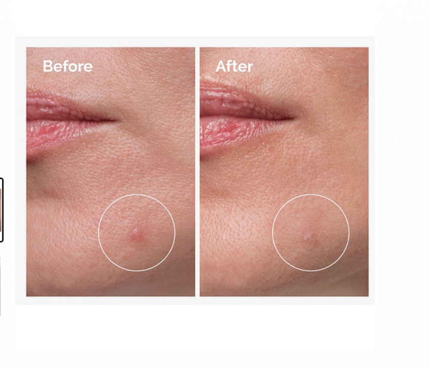 The Ordinary Sulfur 10% Powder to Cream Concentrate 5gr