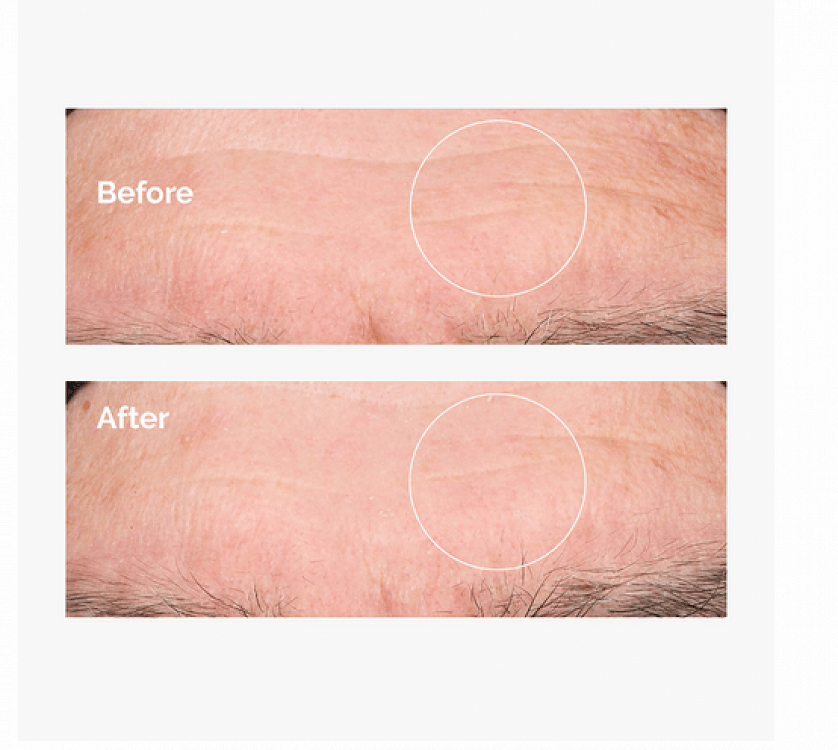 The Ordinary Hyaluronic Acid 2% + B5 60ml