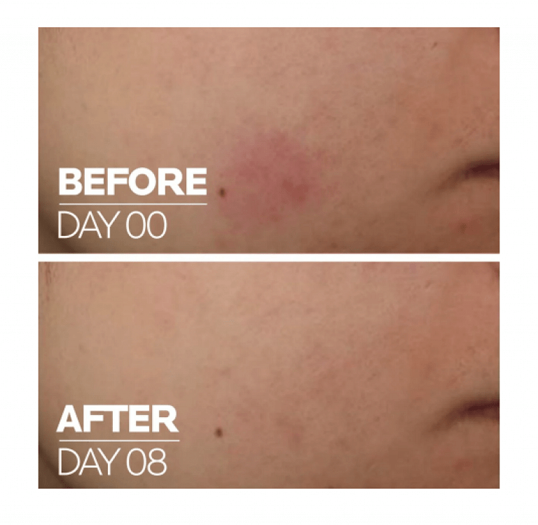 La Roche Posay Cicaplast B5 Serum 30ml
