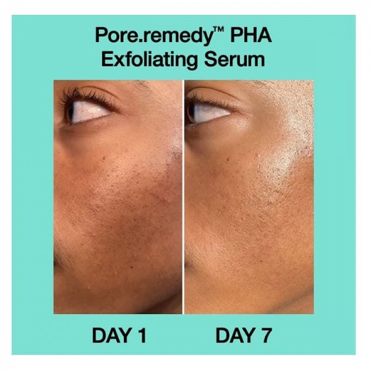 Dr. Jart+ Pore Remedy Exfoliating Face Serum 30ml