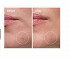 The Ordinary Sulfur 10% Powder to Cream Concentrate 5gr