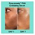 Dr. Jart+ Pore Remedy Exfoliating Face Serum 30ml